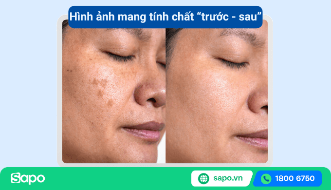 Nội dung mang tính trước sau